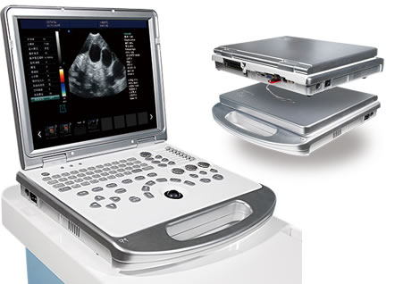 驢用B超機,獸用b超,獸用孕檢B超,毛驢妊娠的直腸檢查法