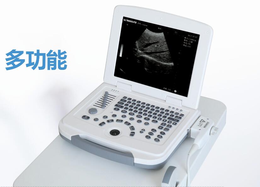 b超機,b超,脂肪肝B超