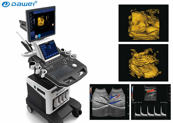 多普勒彩超,多普勒彩超機(jī),彩超機(jī),B超機(jī)